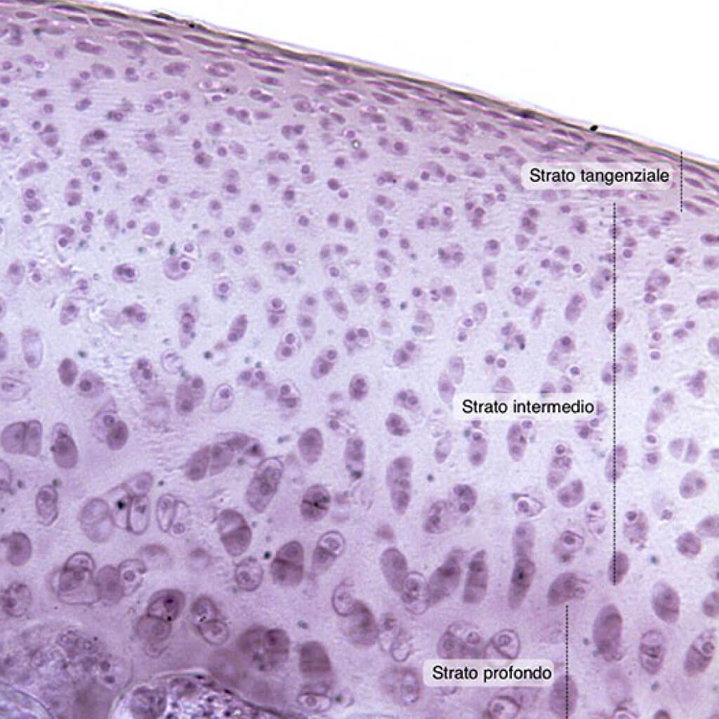 Cartilagine articolare